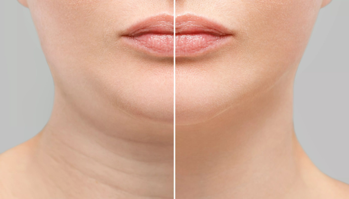 | Dominik Boligłowa