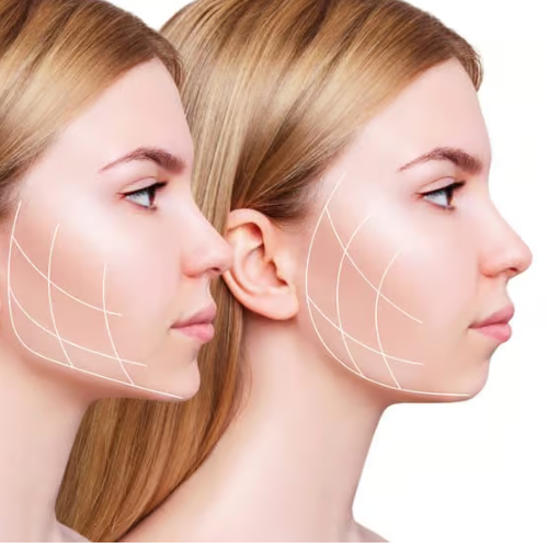 | Dominik Boligłowa